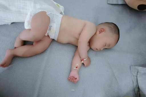 泰州宝宝脸上有白色斑块 泰州宝宝脸上有白色斑块